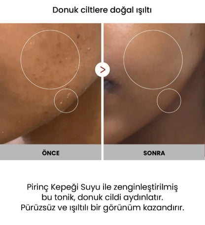 Dermaloria Glow Peel Shot